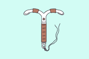 Copper coil IUD illustration