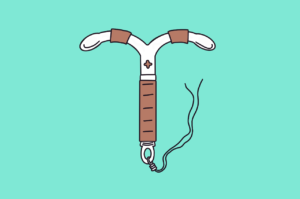 IUD illustration