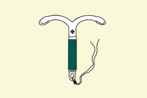 Illustration of an IUS or hormonal coil