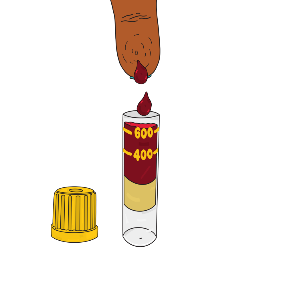 Blood dripping into the container between the two lines