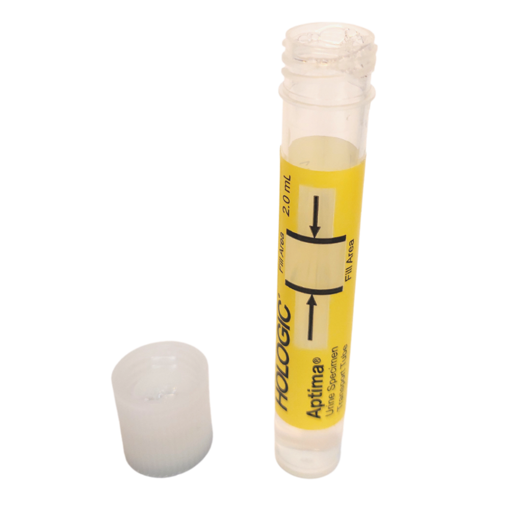 Sample tube with yellow label standing upright with lid next to it