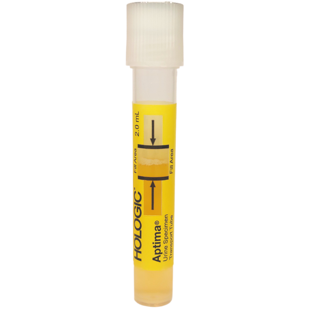 Sample tube filled with urine so that it's between the two black lines on the tube.